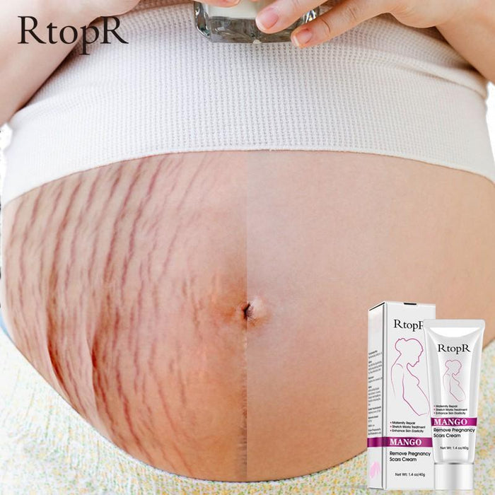 Mango Stretch Mark Skin Repair Cream